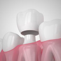 protesi dentale